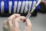 Human Antibodies To Fight Ebola, Human Antibodies To Fight Ebola, new human antibodies to combat ebola, Ebola outbreak