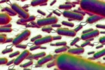 E.coli Outbreak symptoms, E.coli, all about e coli outbreak in the united kingdom, Boots