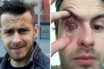 can i wash my face with contact lenses on, is it bad to shower with contacts, contact lens wearers beware man goes blind after parasites eat man s eye as he wore lenses in shower, Contact lens