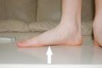 treatment for flat foot, flat foot, flat feet is it serious condition, Biking